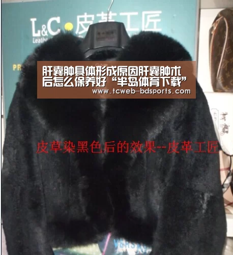 肝囊肿具体形成原因肝囊肿术后怎么保养好“半岛体育下载”(图3) 半岛体育下载